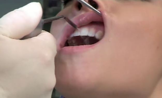 Так при помощи Amazing White отбеливаются зубы  Так при помощи Amazing White отбеливаются зубы