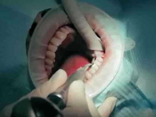 Своевременная гигиена полости рта - залог здоровья зубов и жизненного комфорта