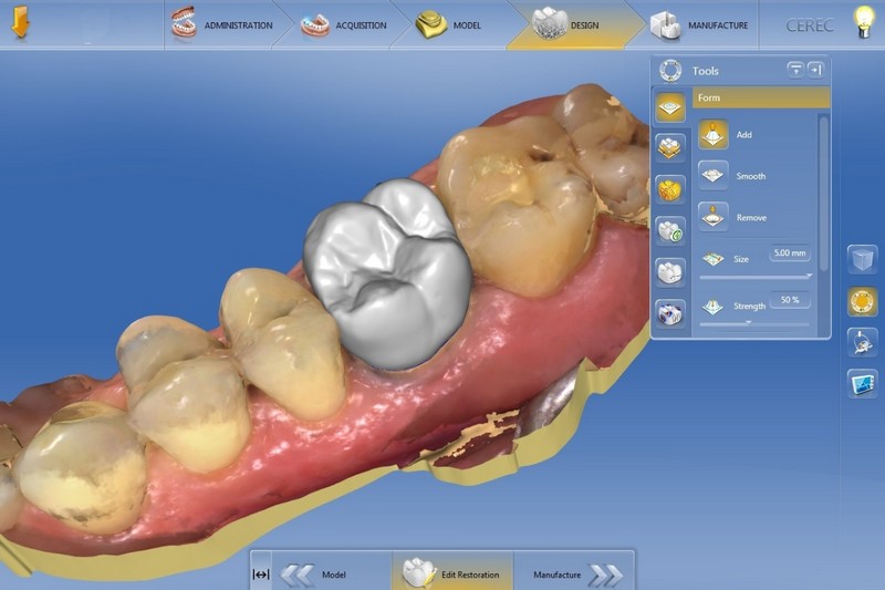 Cистема зубного протезирования, называемая CAD/CAM